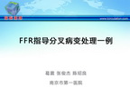 [CCC&CISC2014]FFR指导分叉病变处理一例